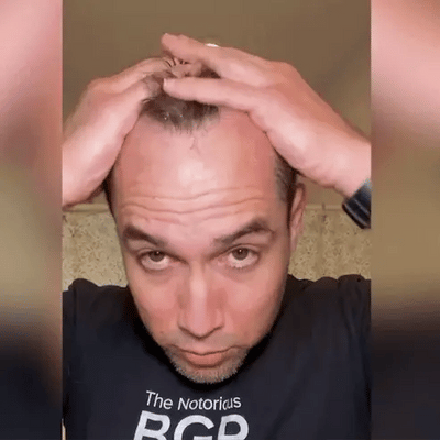 بخاخ FEG لنمو الشعر - تكثيف طبيعي للشعر وإصلاح فروة الرأس | إميرازاار الإمارات العربية المتحدة